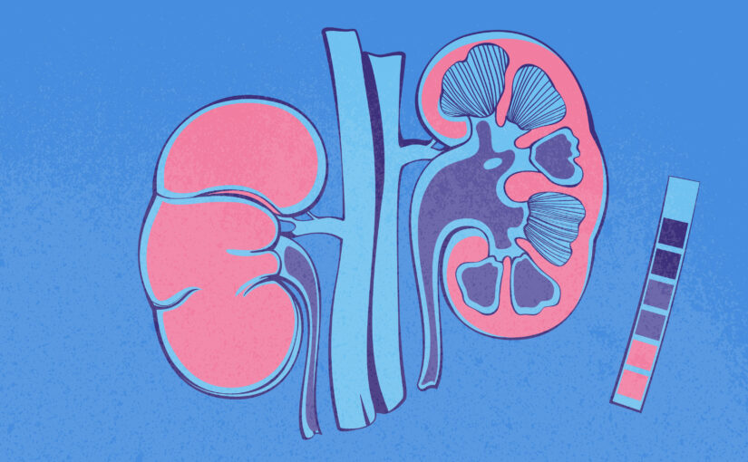 Maladie rénale : dépister tôt pour agir plus vite