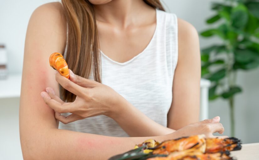 Vers un vaccin thérapeutique pour les allergies alimentaires