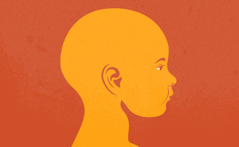 Jaunisse ou ictère du nouveau-né : de quoi s’agit-il ?