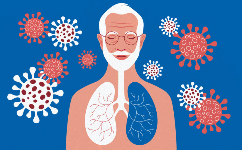 Bronchiolite : les seniors aussi sont concernés