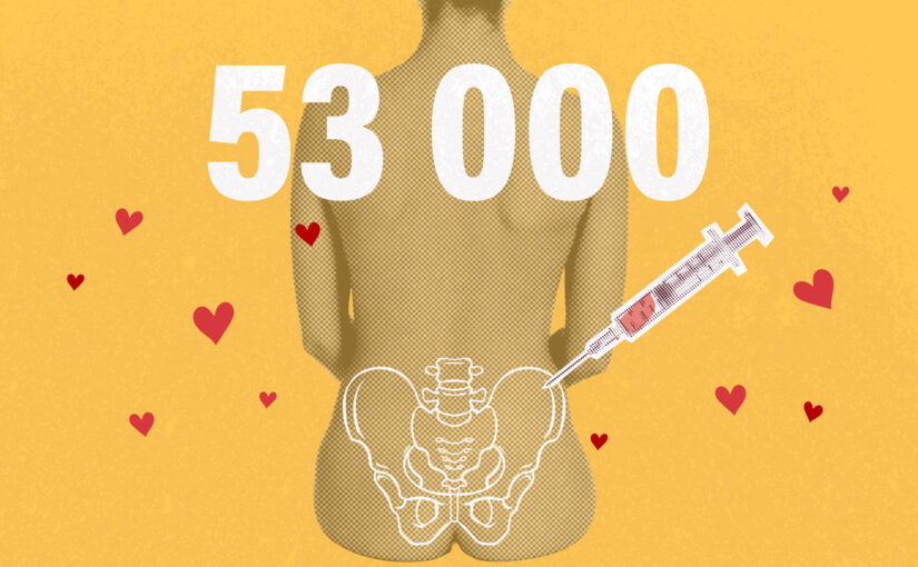 53 000